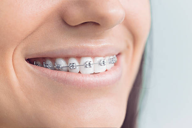 Why Choose Us for Your Dental Needs in Grand Junction, CO